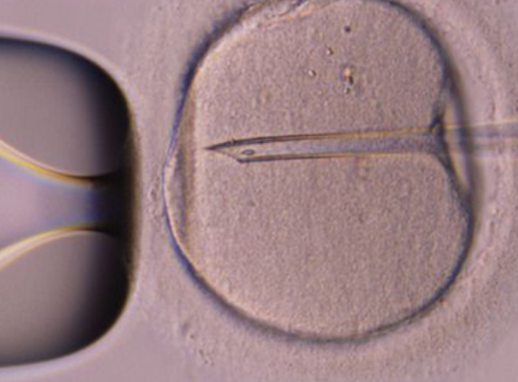 第三代试管婴儿胚胎的染色体筛查。
